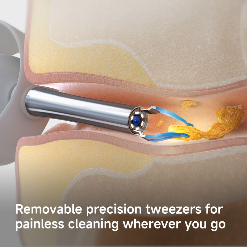 Bebird EarSight Plus Earwax Removal Tool Ear Canal Cleaner, Equipped With A Camera For Ear Nose Throat Examination.