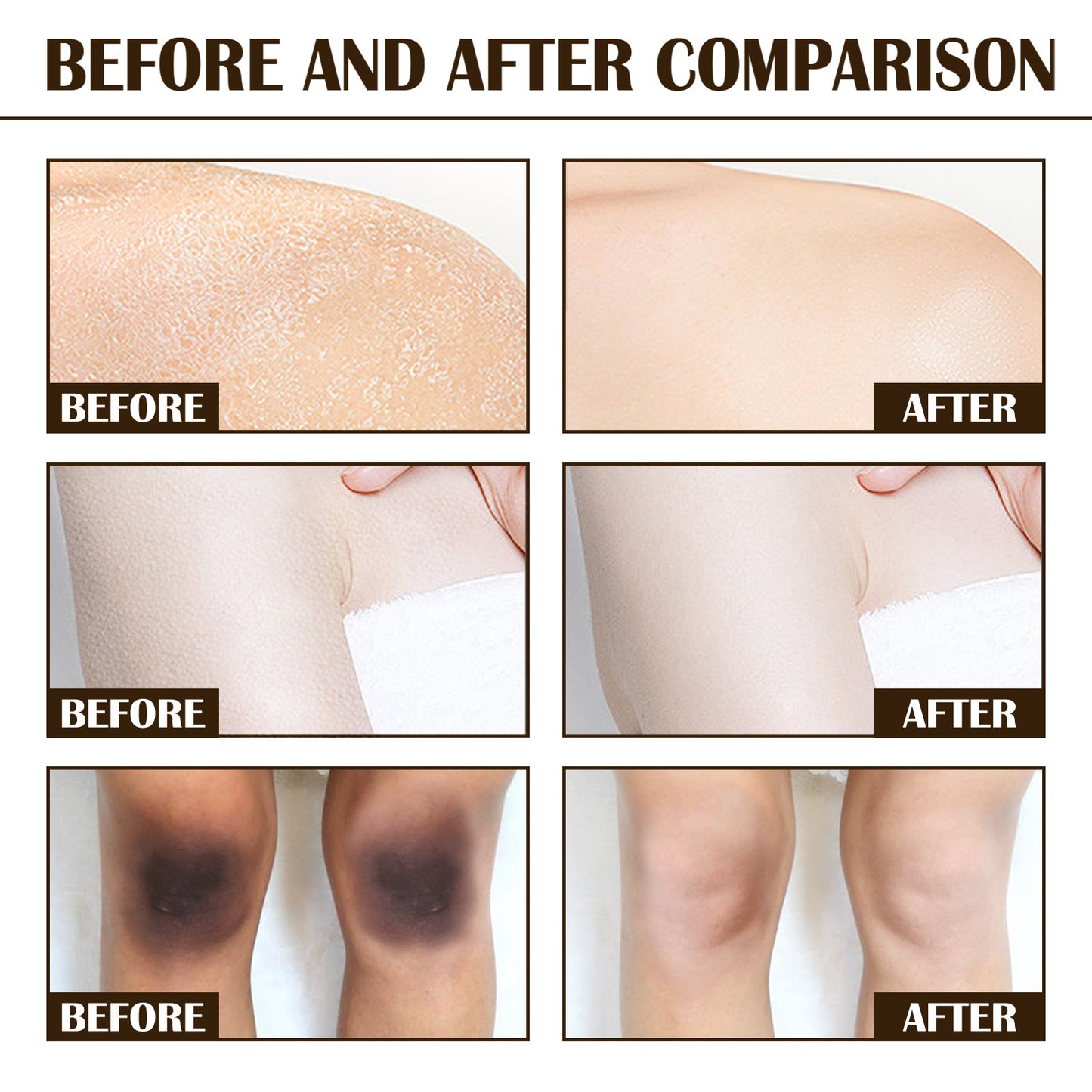 Melanin Brightening And Whitening Body Skin Coffee Scrub