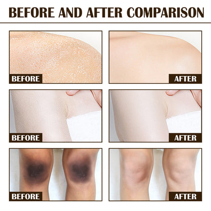 Melanin Brightening And Whitening Body Skin Coffee Scrub