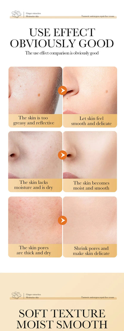 Natural Handmade Turmeric Soap Face Cream Serum Skin Care Set Clean Cutin Oil Control Removal Acne Whitening Remove Dark Spots - AR Perk Inc